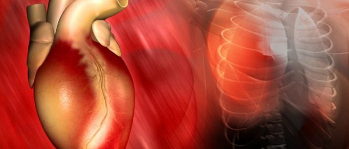 Cardiosclerosis латынь. Миокардический кардиосклероз. Постинфарктный кардиосклероз.